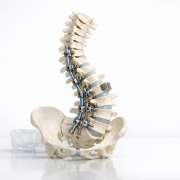 42e093e6-managing-a-patient-with-spinal-deformity.png Managing a Patient with Spinal Deformity