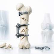 63daff4b-understanding-the-different-types-of-bone-fractures-and-their-classification.png Understanding the Different Types of Bone Fractures and Their Classification
