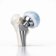 eaaacfc0-partial-hip-replacement-an-alternative-to-consider.png Partial Hip Replacement: An Alternative to Consider