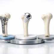 The Proximal Humerus Dilemma: Fix It, Replace It, or Leave It Alone?