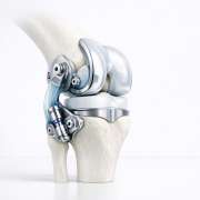 From Static to Dynamic: Why We’re Moving Toward Functional Knee Stability