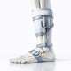 Wearable Tech: The Next Frontier in Post-Traumatic Gait Analysis