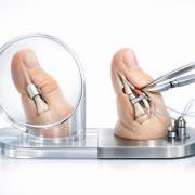 Management of Pediatric Trigger Thumb: Observation vs. Release