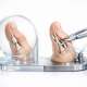 Management of Pediatric Trigger Thumb: Observation vs. Release