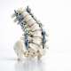 Why Surgeon Volume Matters for Complex Spinal Deformity Outcomes
