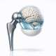 The Case for Routine Psychological Screening Before Joint Replacement