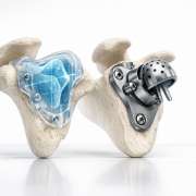 The Case for Augmented Reality in Complex Glenoid Deformity Correction