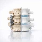 65cc14a6-rethinking-the-normal-aging-spine-when-is-imaging-necessary.png Rethinking the “Normal” Aging Spine: When Is Imaging Necessary?