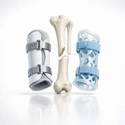 bcce72d3-rethinking-the-splint-is-rigid-immobilization-doing-more-harm-than-good.png Rethinking the Splint: Is Rigid Immobilization Doing More Harm Than Good?