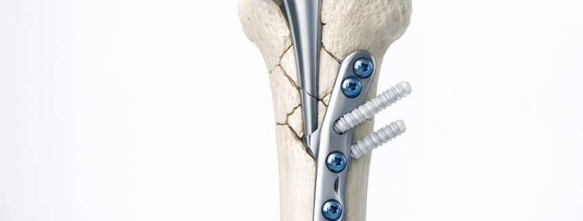 Lessons from Geriatric Trauma: Why Age-Specific Protocols Matter