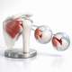 Understanding the Neer and Gerber Classifications for Subscapularis Tears