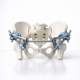 The Case for Outpatient Management of Stable Pelvic Ring Injuries